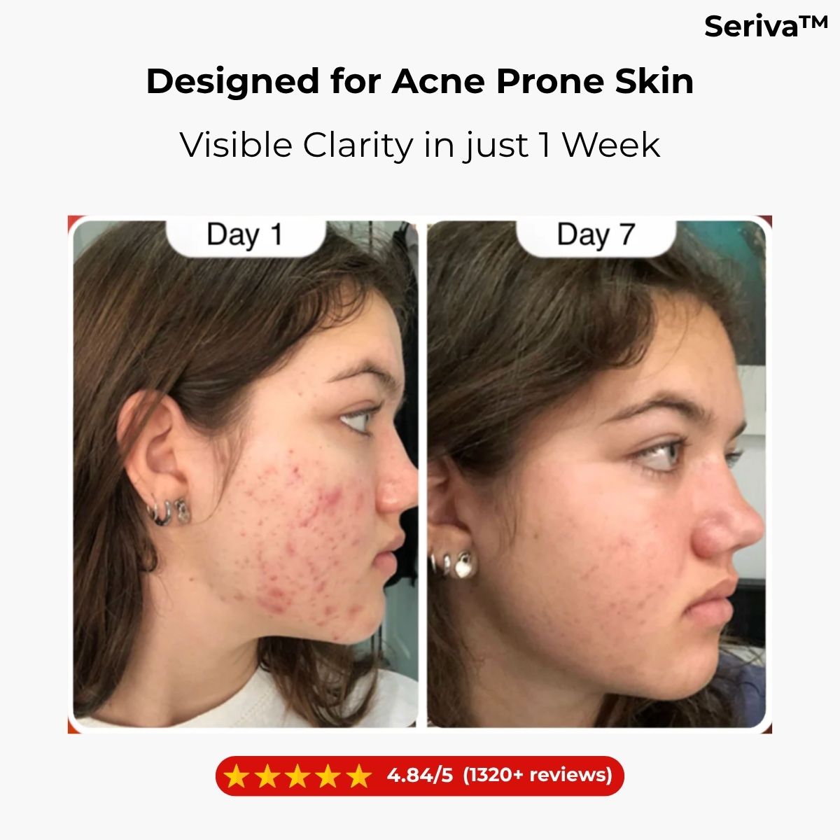 Seriva™ Hypochlorous Acid Peel Shot Face & Body Set