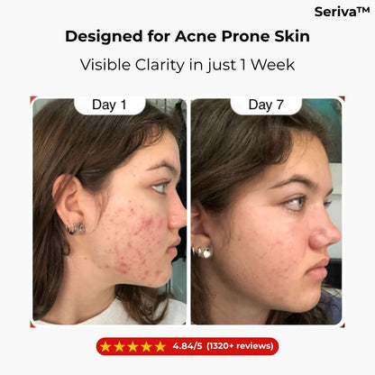 Seriva™ Hypochlorous Acid Peel Shot Face & Body Set